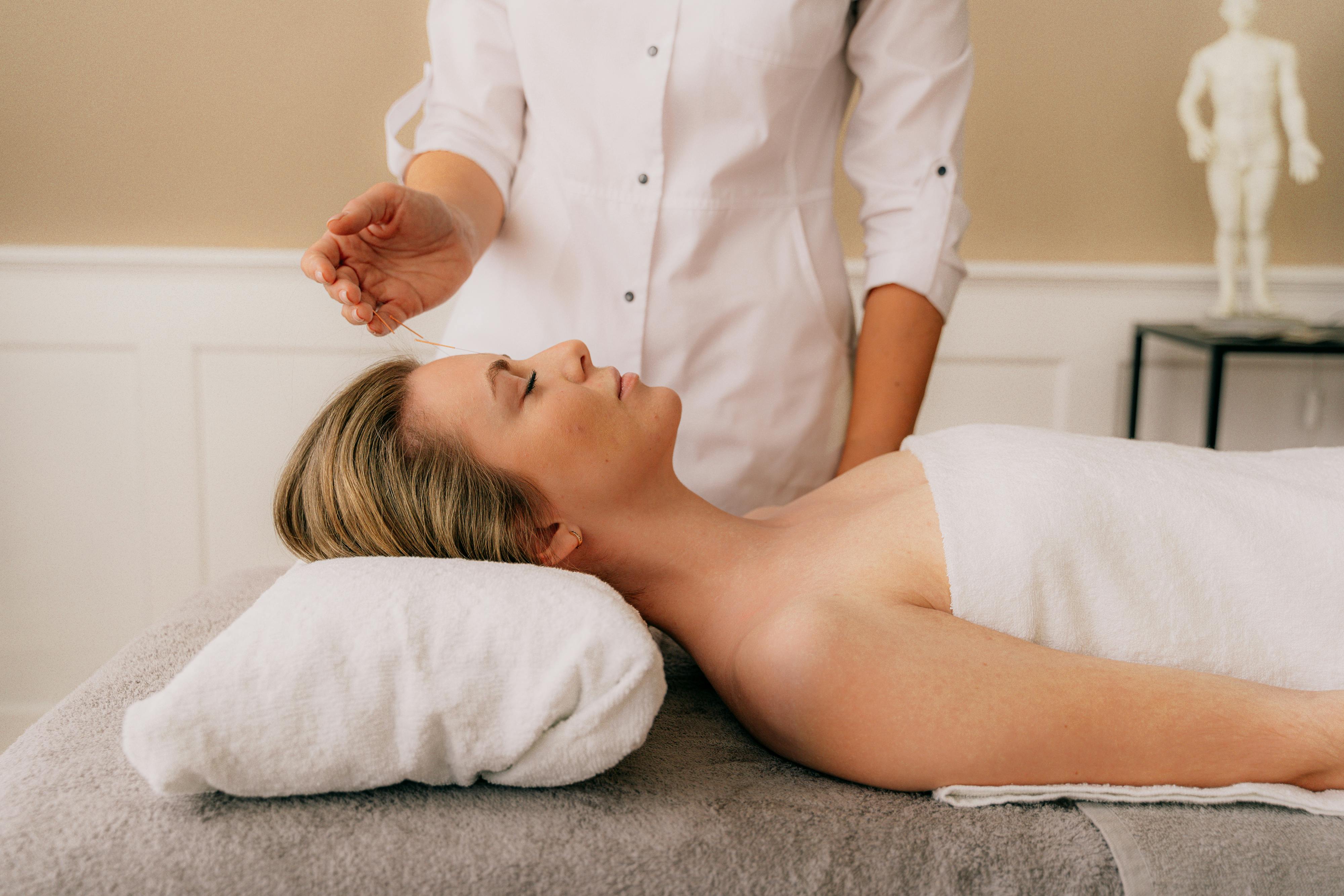 Acupuncture